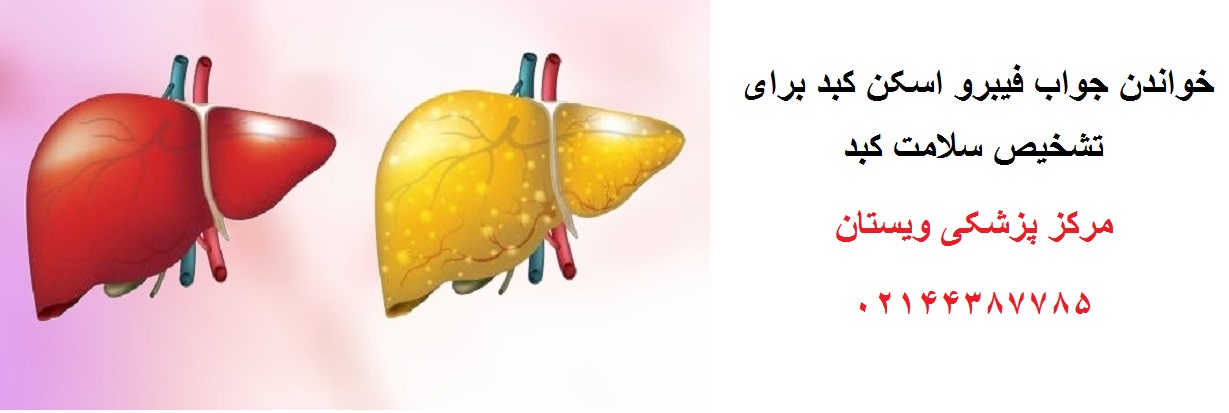 خواندن جواب فیبرو اسکن کبد