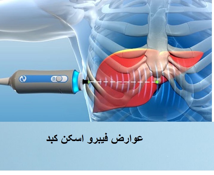 عوارض فیبرو اسکن کبد