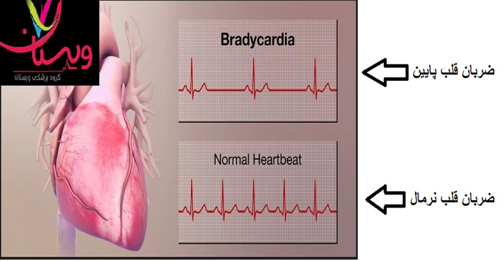 ضربان قلب خطرناک و نرمال