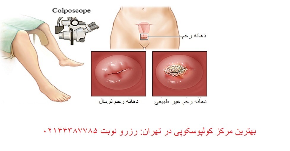 بهترین مرکز کولپوسکوپی در مرزداران
