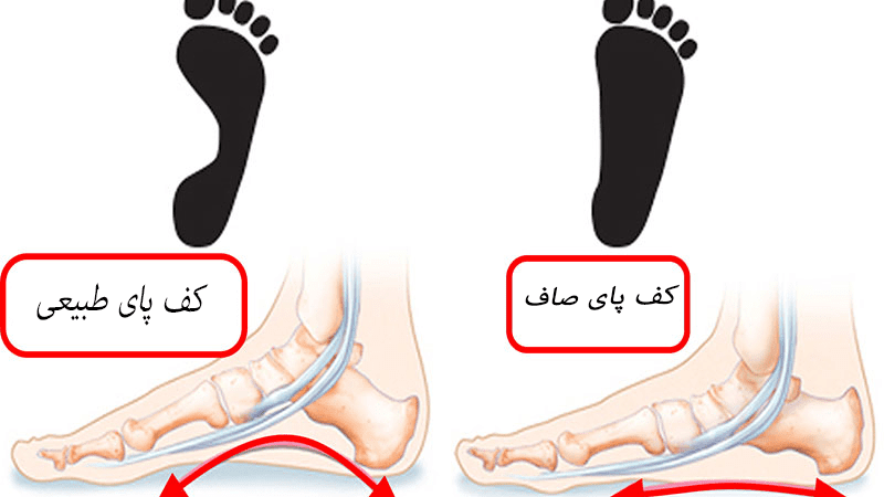 متخصص کف پای صاف