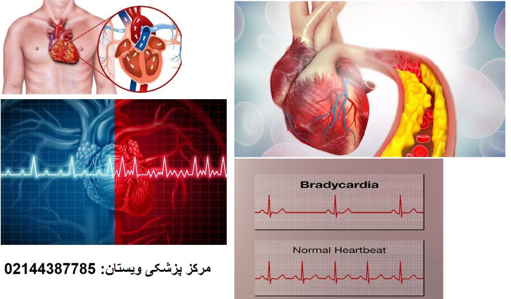 بهترین بیمارستان خصوصی قلب در غرب تهران | کلینیک قلب ویستان