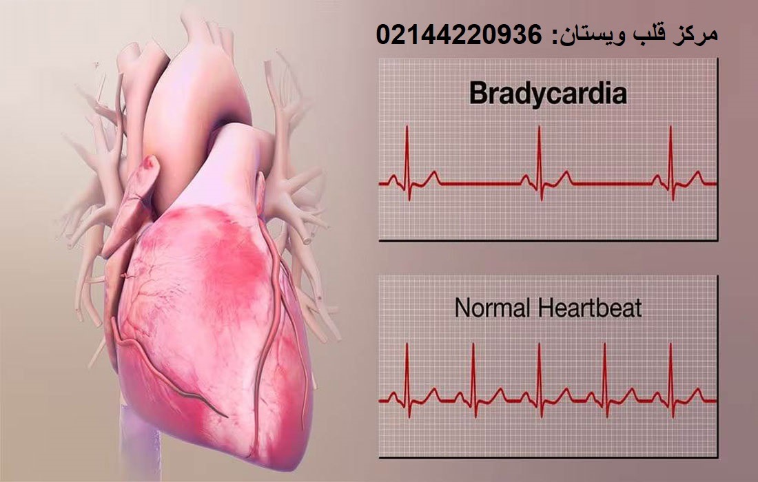 مرکز قلب ویستان