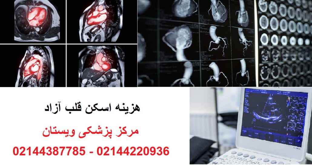 هزینه اسکن قلب آزاد در سال 1404 | قیمت اسکن قلب رنگی تهران