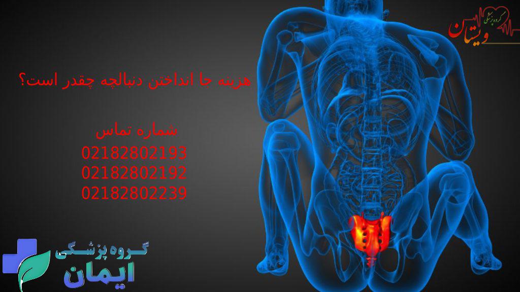 شماره تلفن های کلینیک ویستان برای جا انداختن دنبالچه به صورت فوری در تهران