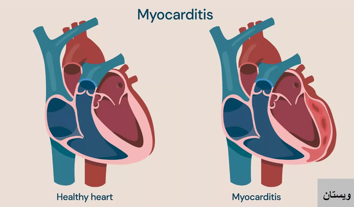 درمان مشکلات قلب