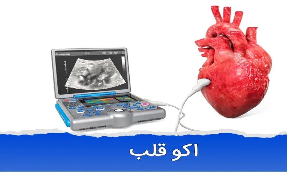 اکو قلب در تهران