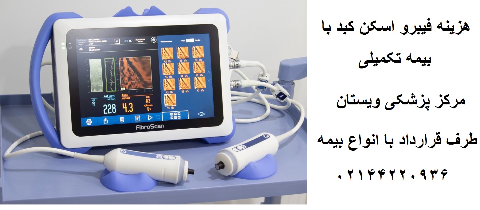 هزینه فیبرو اسکن کبد با بیمه تکمیلی