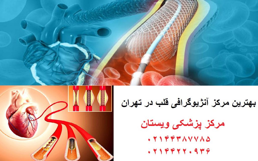 طول عمر بعد از سکته قلبی| راز افزایش طول عمر پس از حمله قلبی