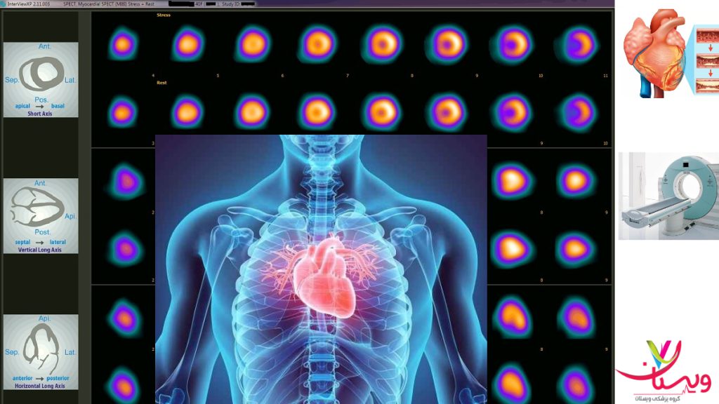 عکس رنگی از قلب