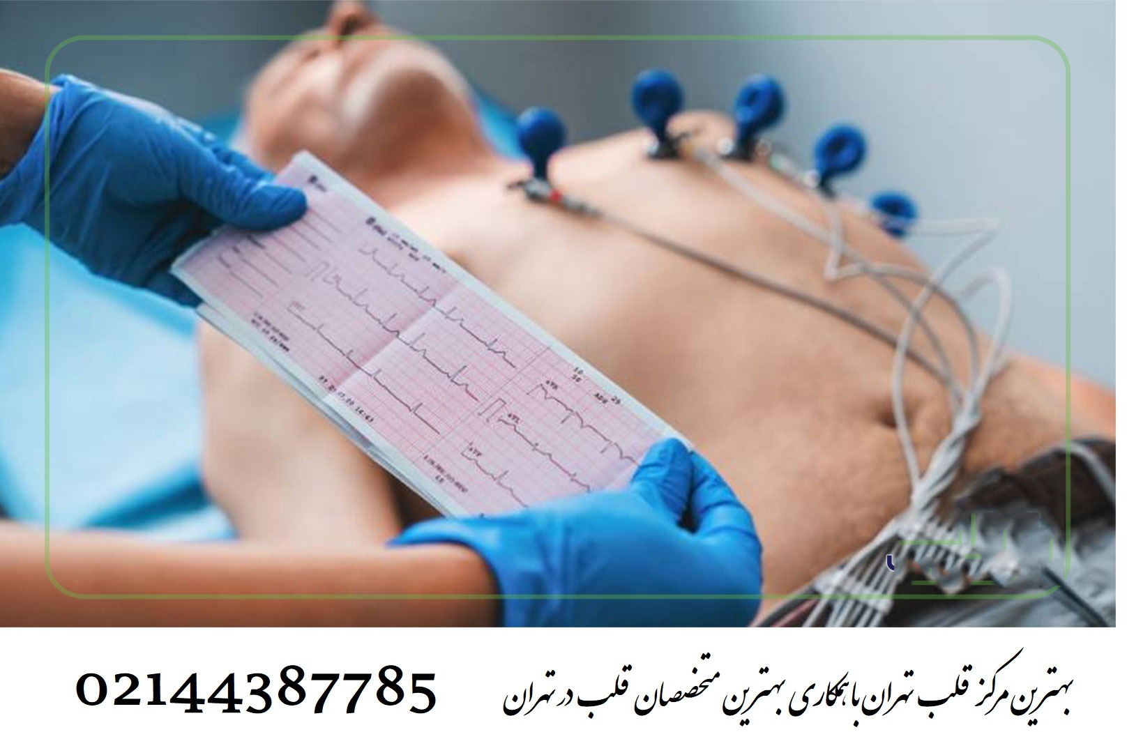 📊 آمار مرگ و میر بعد از سکته قلبی