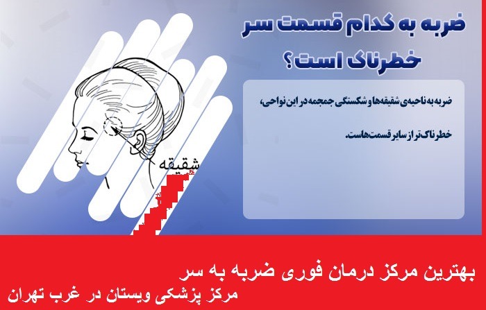  ضربه به گیجگاه 