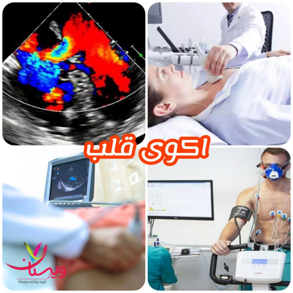 هزینه اکو قلب در کلینیک‌ خصوصی با بیمه دی