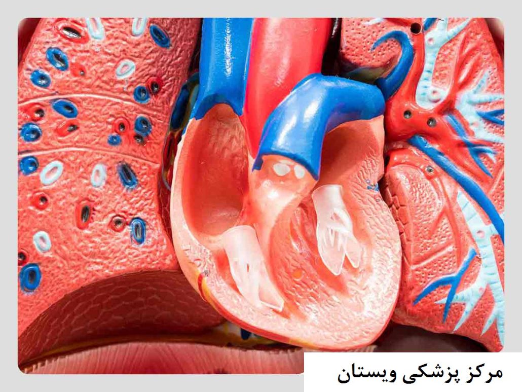 کدام درد قلب خطرناک است (7 نشانه) مراکز درمانی قلب در تهران✔