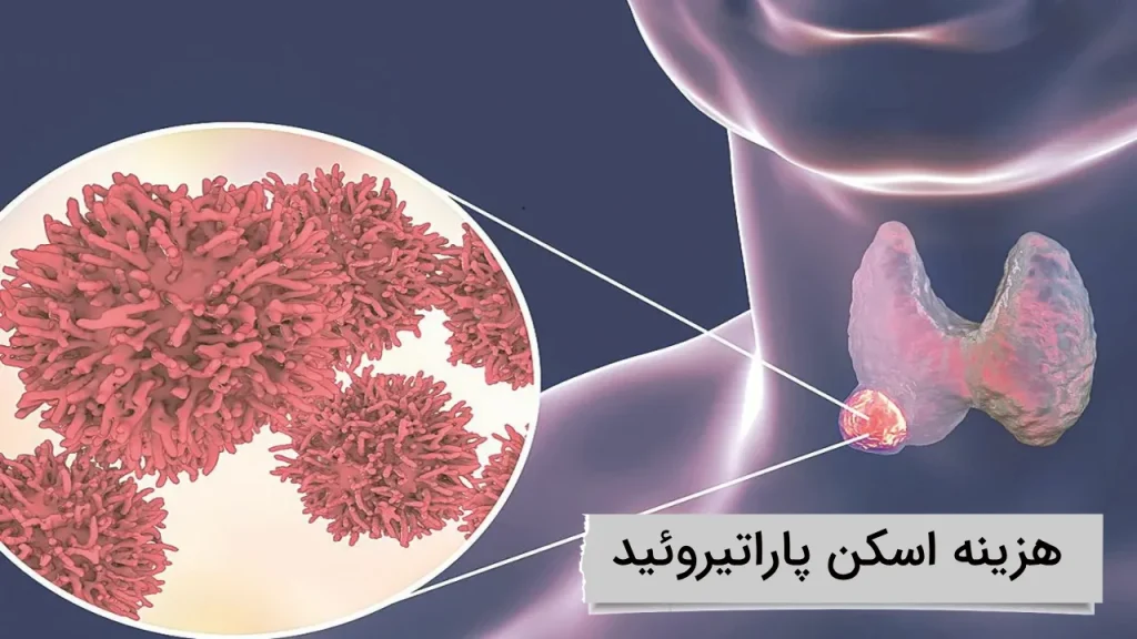 هزینه اسکن هسته ای پاراتیروئید