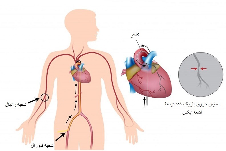 ارتباط قلب و پا
