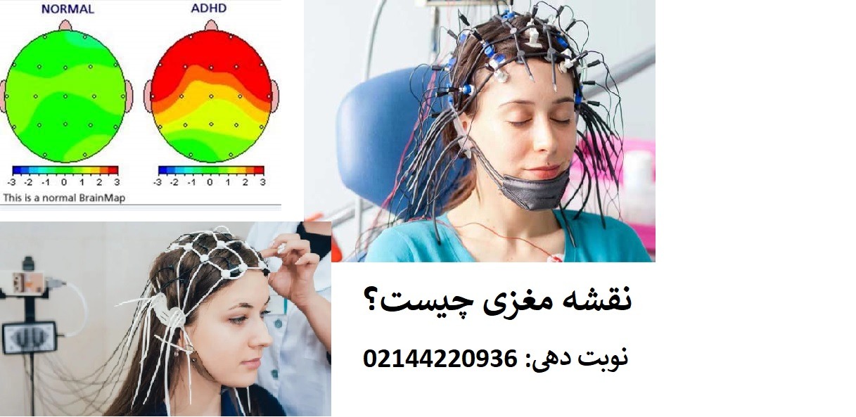 روند انجام تست نقشه مغزی