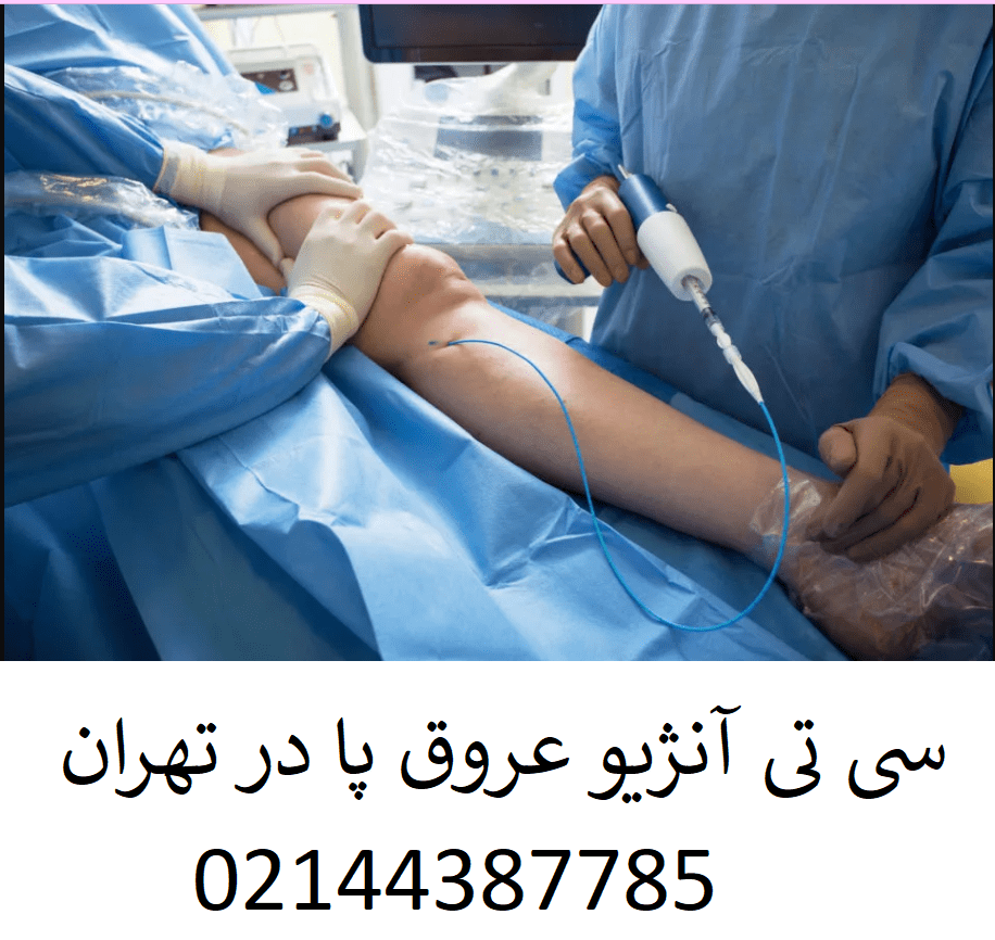 بهترین مرکز سی تی آنژیو عروق پا در تهران