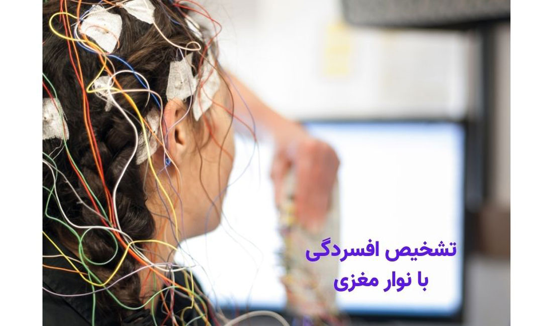 تشخیص افسردگی با نقشه مغزی