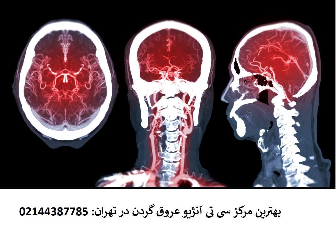 بهترین مرکز سی تی آنژیو عروق گردن در تهران