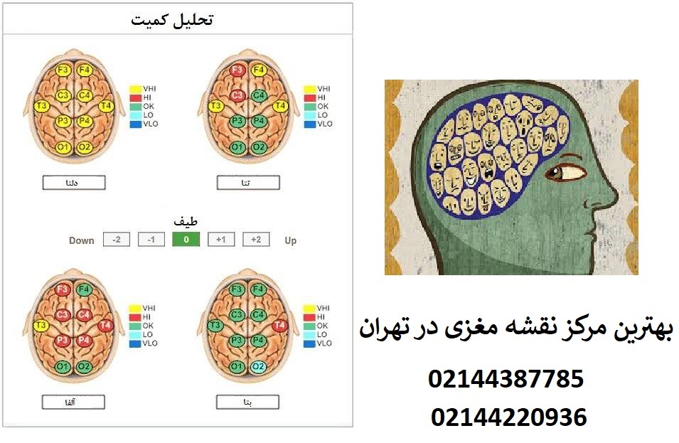 تفسیر نقشه مغزی افراد دوقطبی