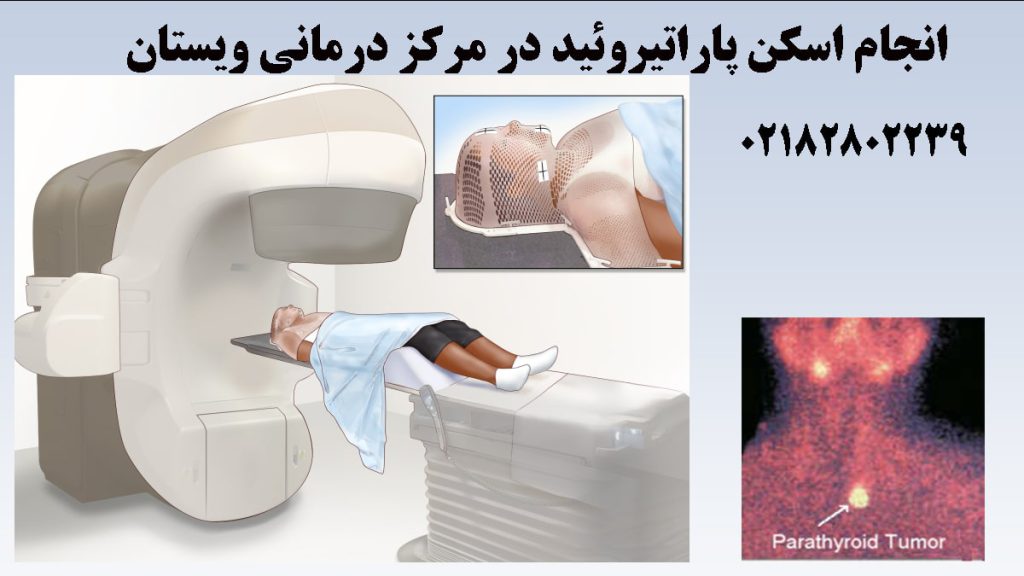 بهترین مرکز اسکن پاراتیروئید در تهران