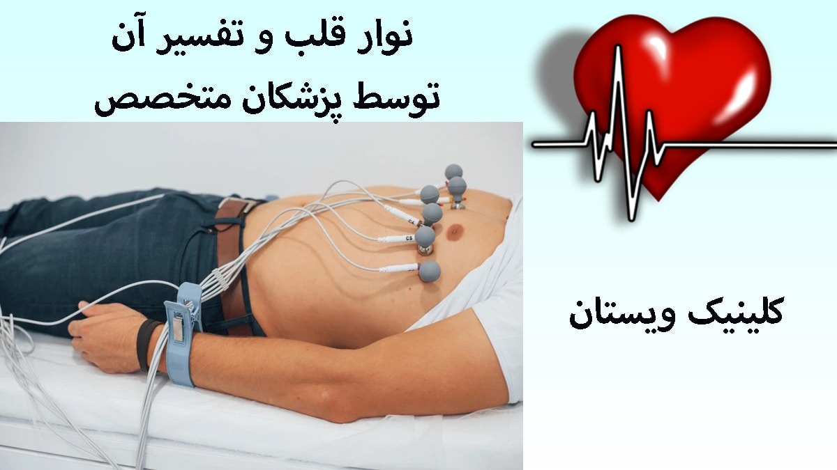 نوار قلب در مرکز پزشکی ویستان