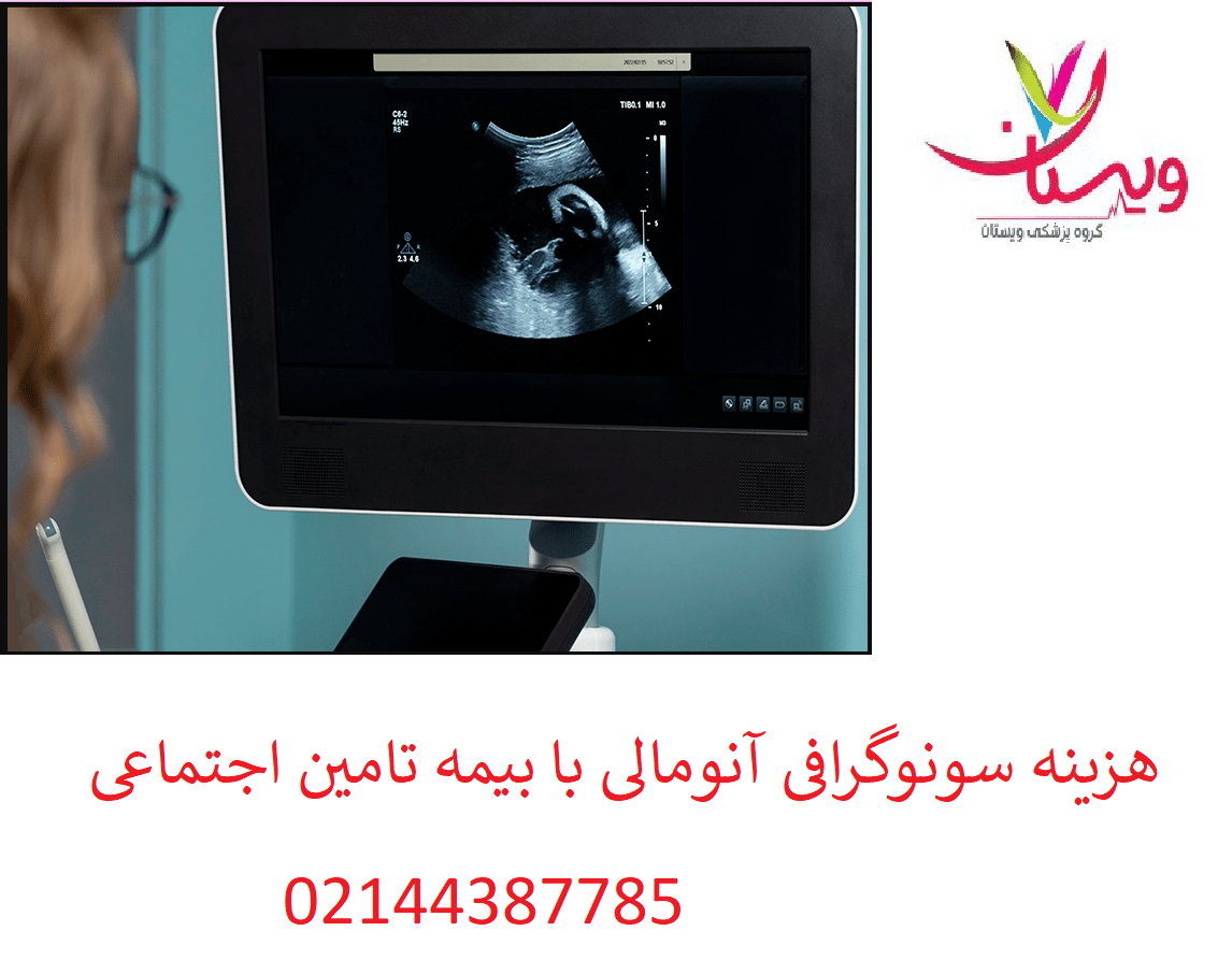 هزینه سونوگرافی آنومالی