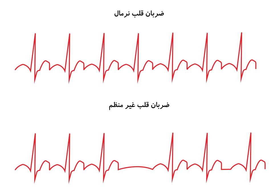 پایین اوردن ضربان قلب