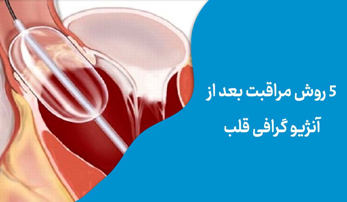 مراقبت های بعد از آنژیوگرافی در منزل