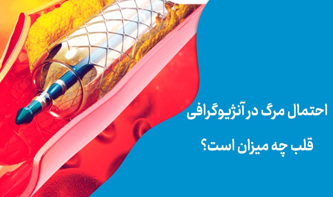 مرگ بعد از آنژیوگرافی
