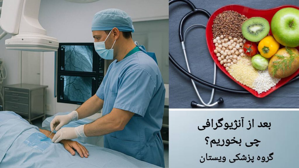 بعد از آنژیوگرافی قلب چی بخوریم؟