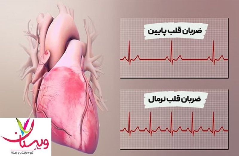 پایین اوردن ضربان قلب فوری