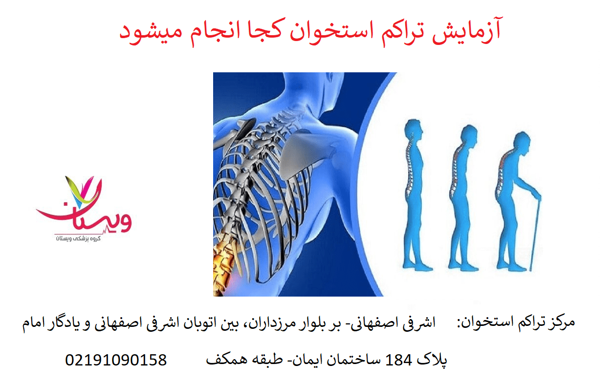 آزمایش تراکم استخوان کجا انجام میشود