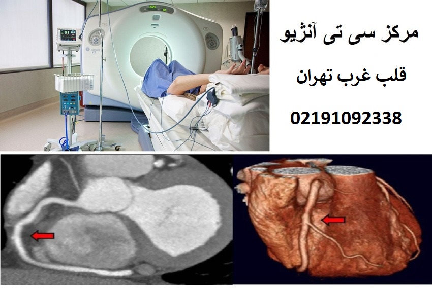 بهترین مرکز سی تی آنژیو قلب با بیمه سلامت غرب تهران