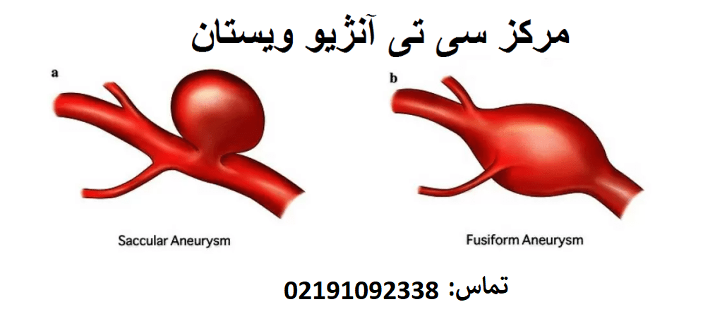 مرکز سی تی آنژیو قلب ویستان