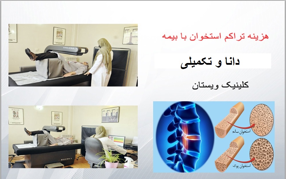 هزینه سنجش تراکم استخوان با بیمه دانا 
