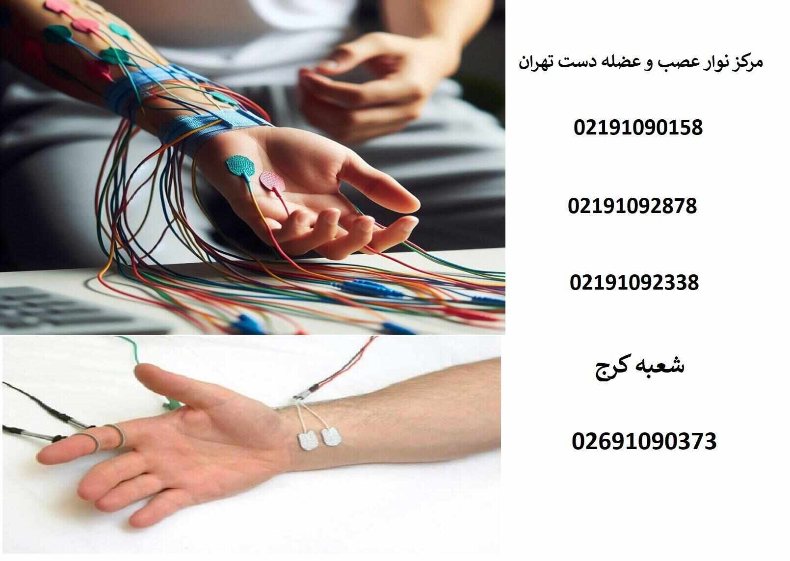 فرایند نوار عصب و عضله برای گزگز دست