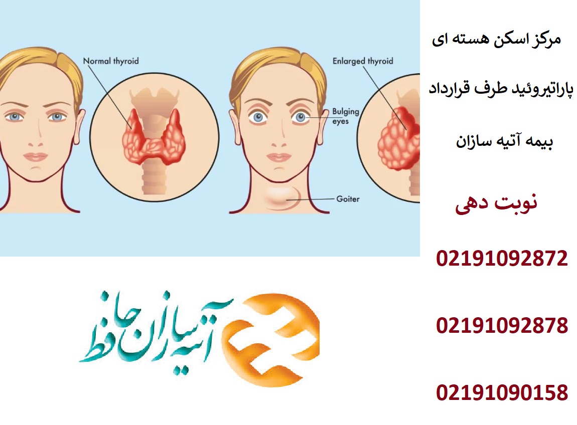 هزینه اسکن هسته ای پاراتیروئید با بیمه آتیه سازان حافظ