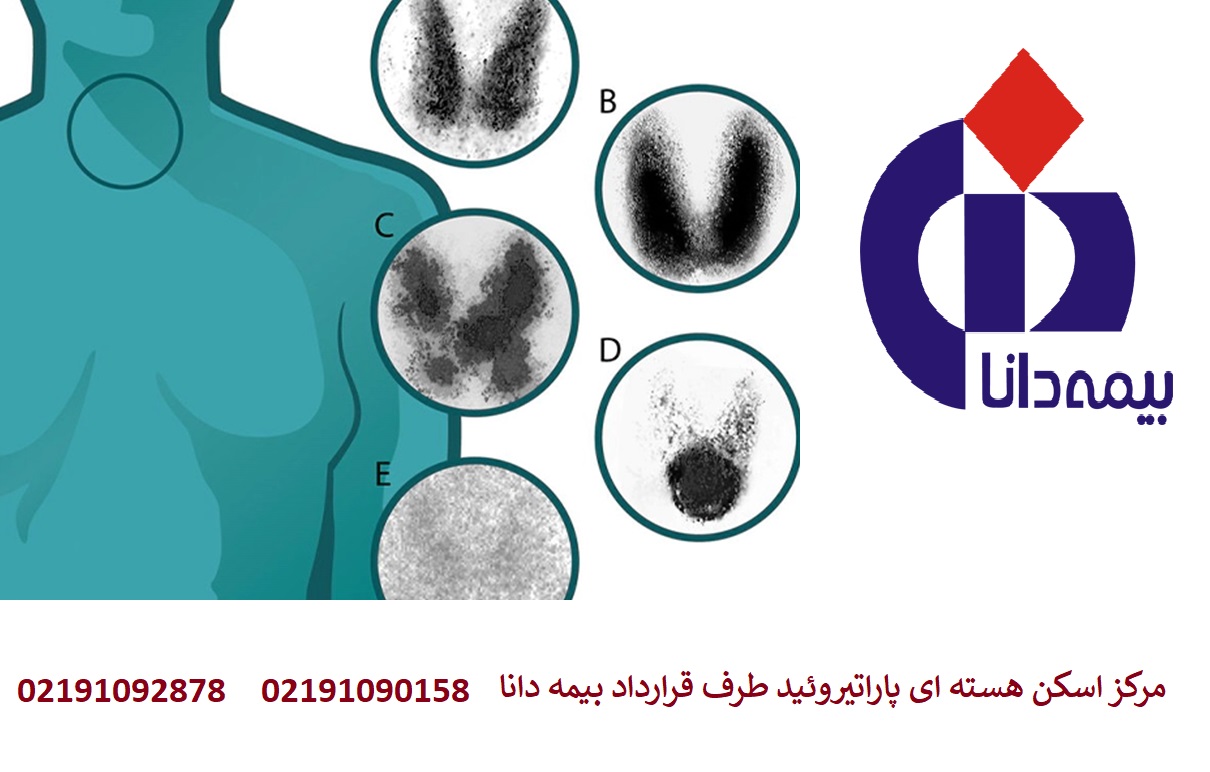 هزینه اسکن هسته‌ ای پاراتیروئید با بیمه دانا