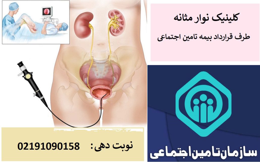 هزینه نوار مثانه با بیمه تامین اجتماعی 1405