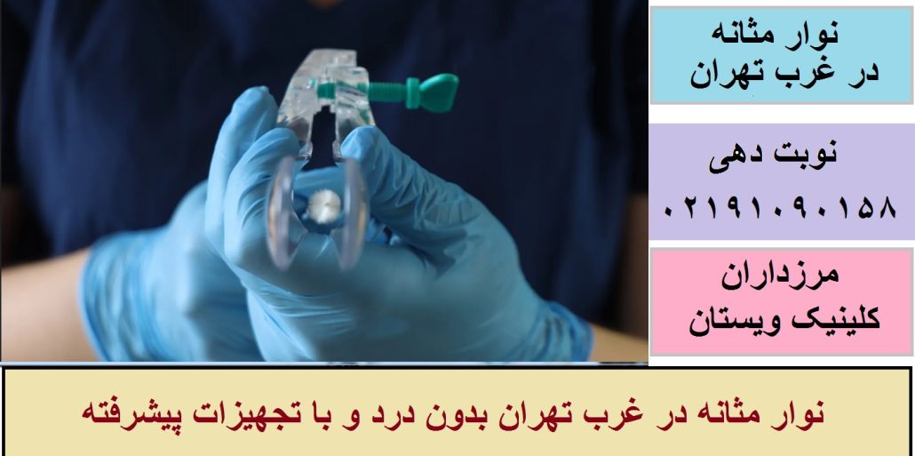 نوار مثانه در غرب تهران بدون درد و با تجهیزات پیشرفته
