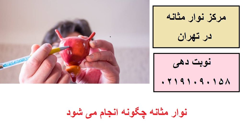نوار مثانه چگونه انجام می شود
