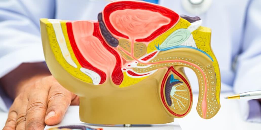ام آر آی پروستات