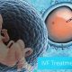 هزینه ivf