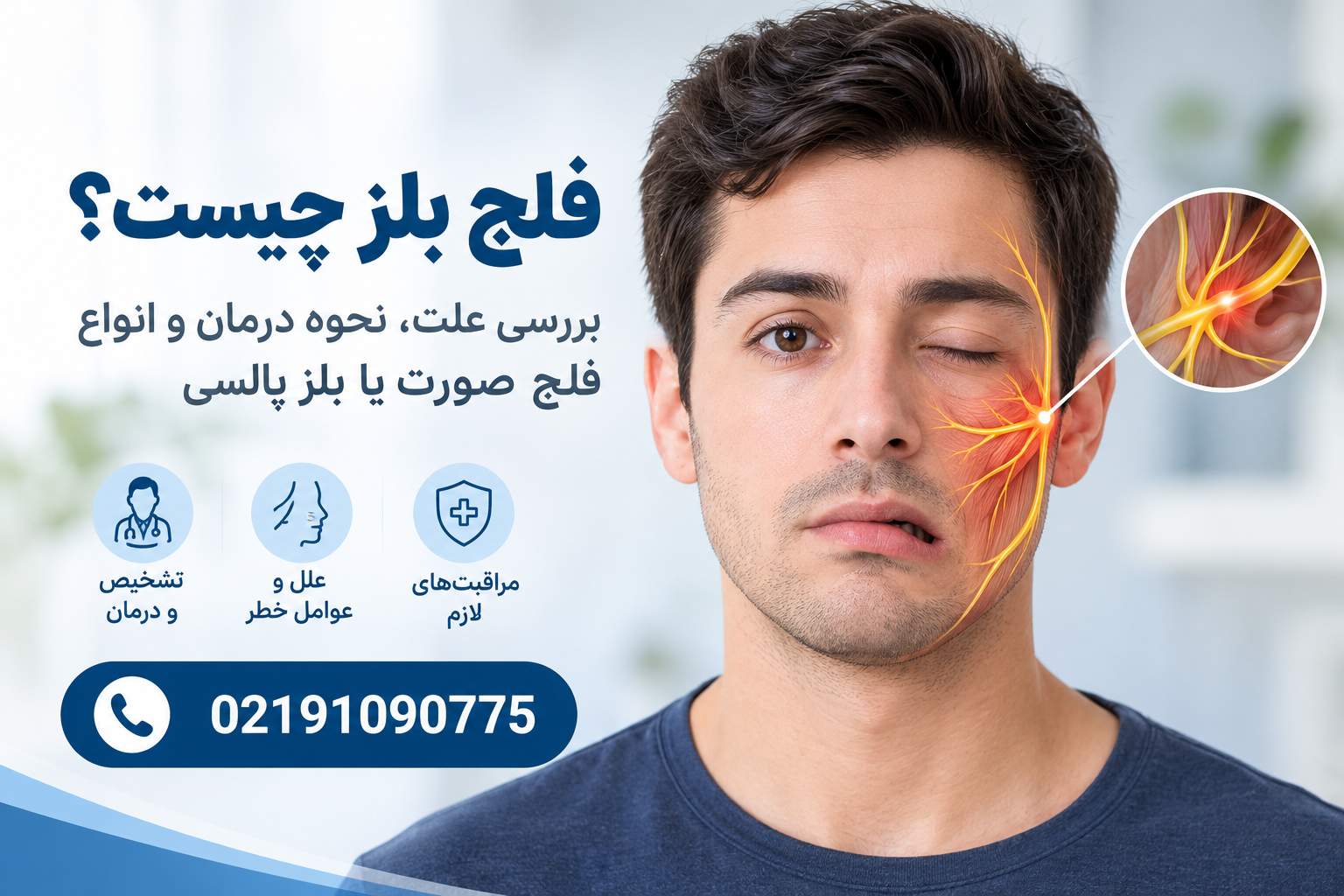 علت های فلج بلز