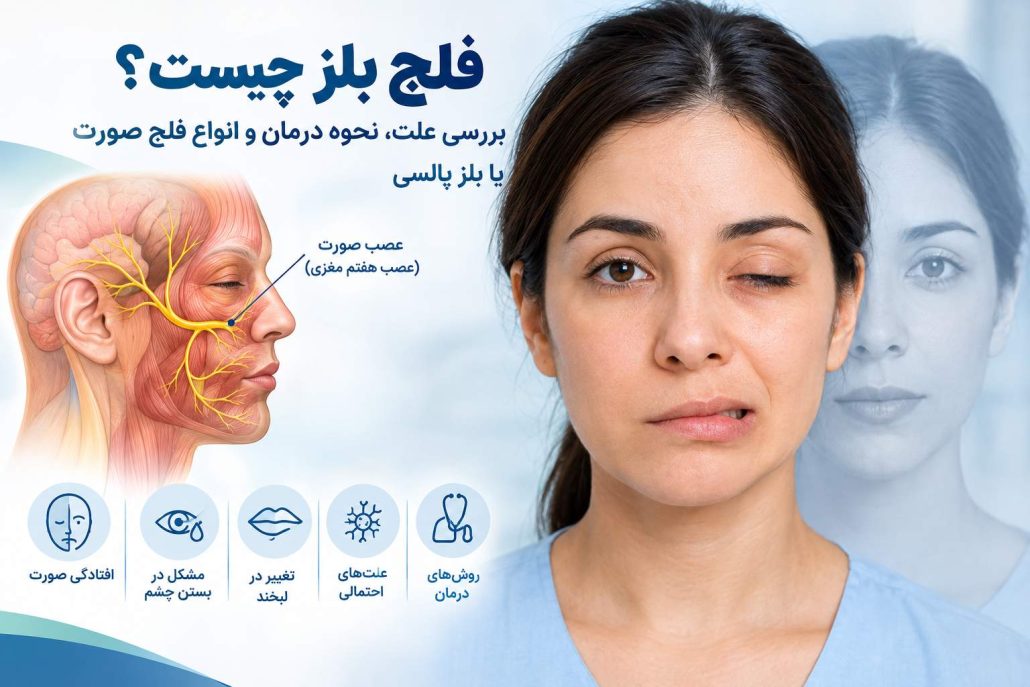 فلج بلز چیست؟