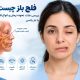 فلج بلز چیست؟